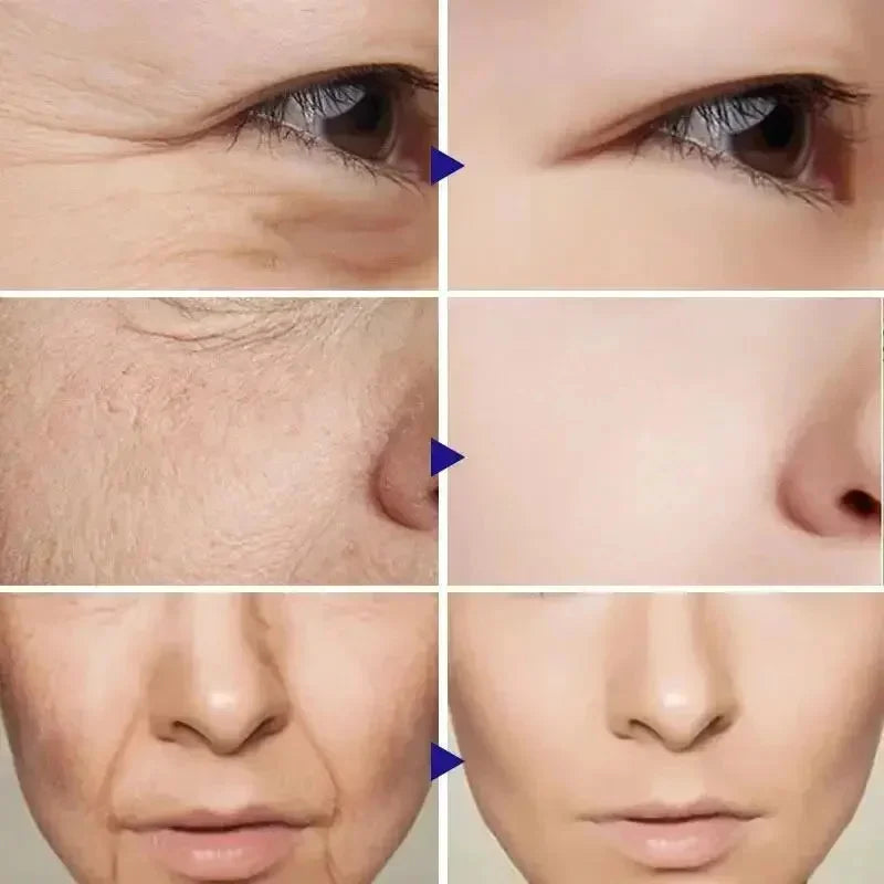 SERUM RETINOL