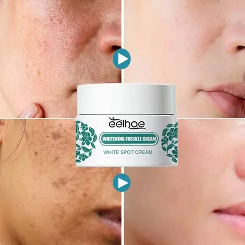 Vitamin C Whitening Freckles Face Cream Remove Melasma Dark Spots Lighten Melanin Acne Scar Anti-aging Brighten Face Skin Care