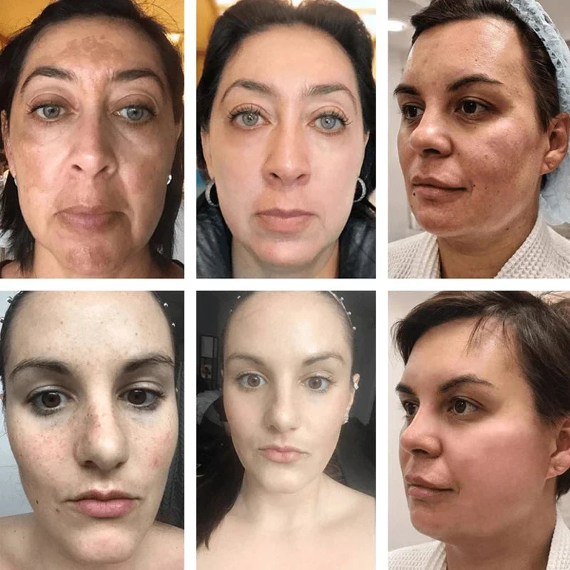 SERUM VITAMINA C