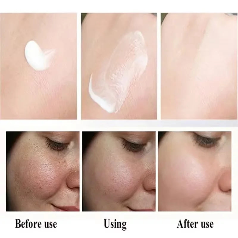 Vitamin C Whitening Freckles Face Cream Remove Melasma Dark Spots Lighten Melanin Acne Scar Anti-aging Brighten Face Skin Care