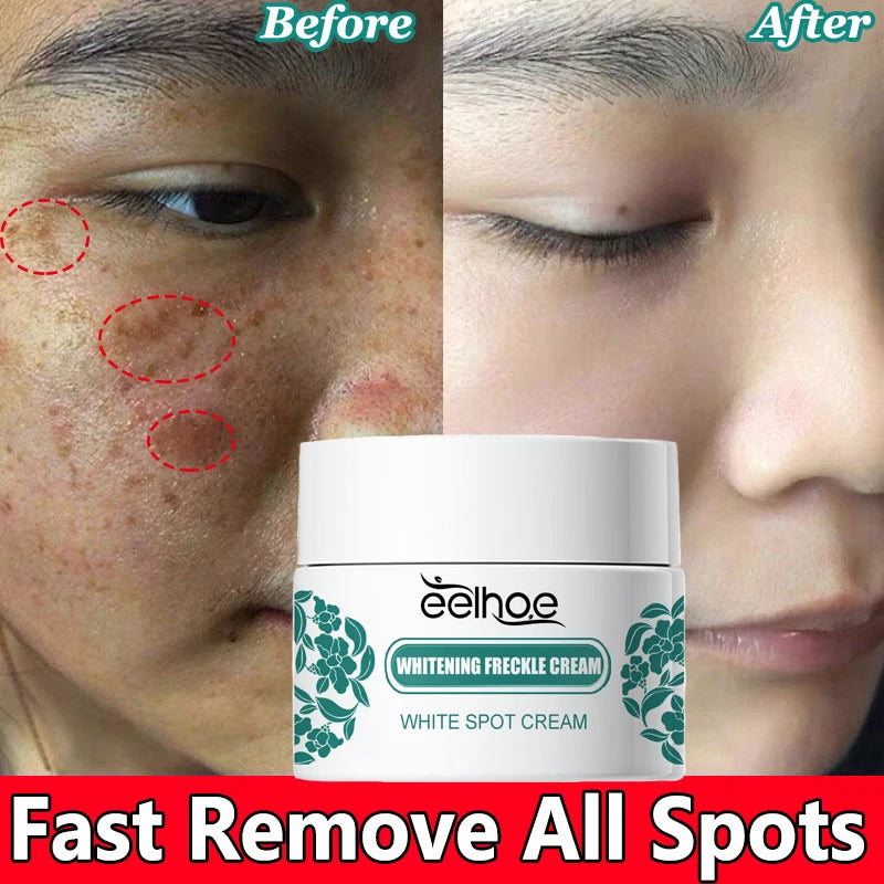 Vitamin C Whitening Freckles Face Cream Remove Melasma Dark Spots Lighten Melanin Acne Scar Anti-aging Brighten Face Skin Care