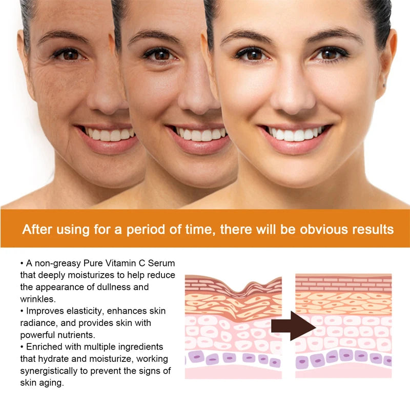 SERUM VITAMINA C
