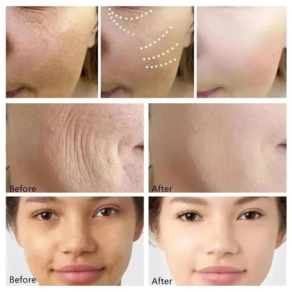 CREMA RETINOL