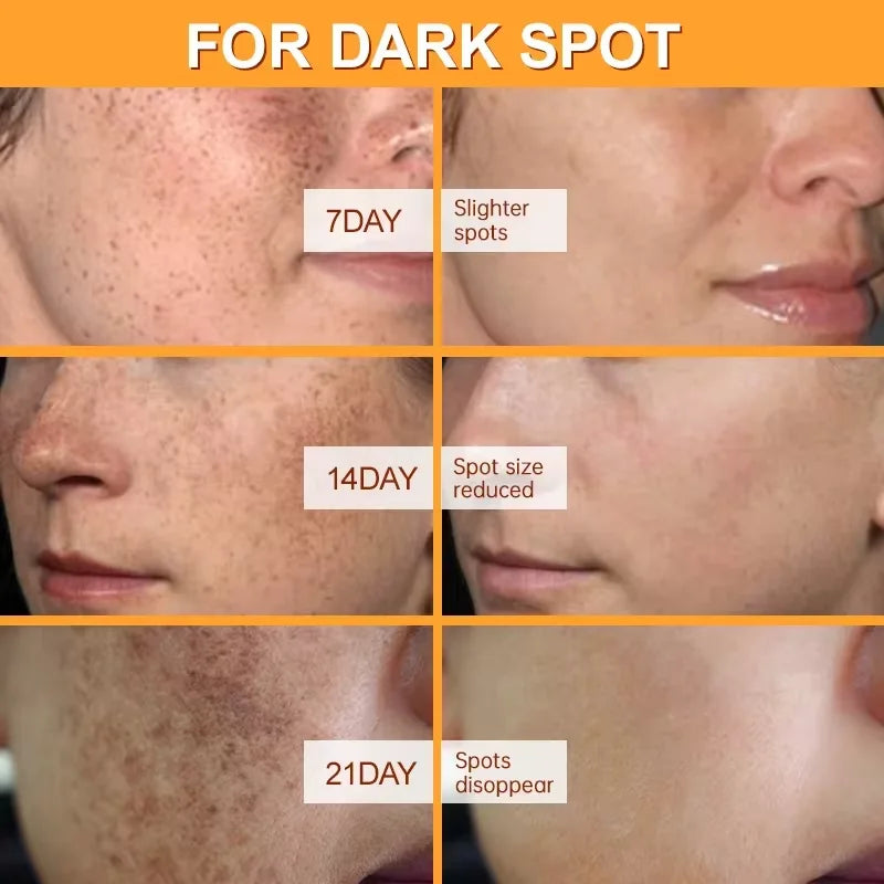 SERUM VITAMINA C