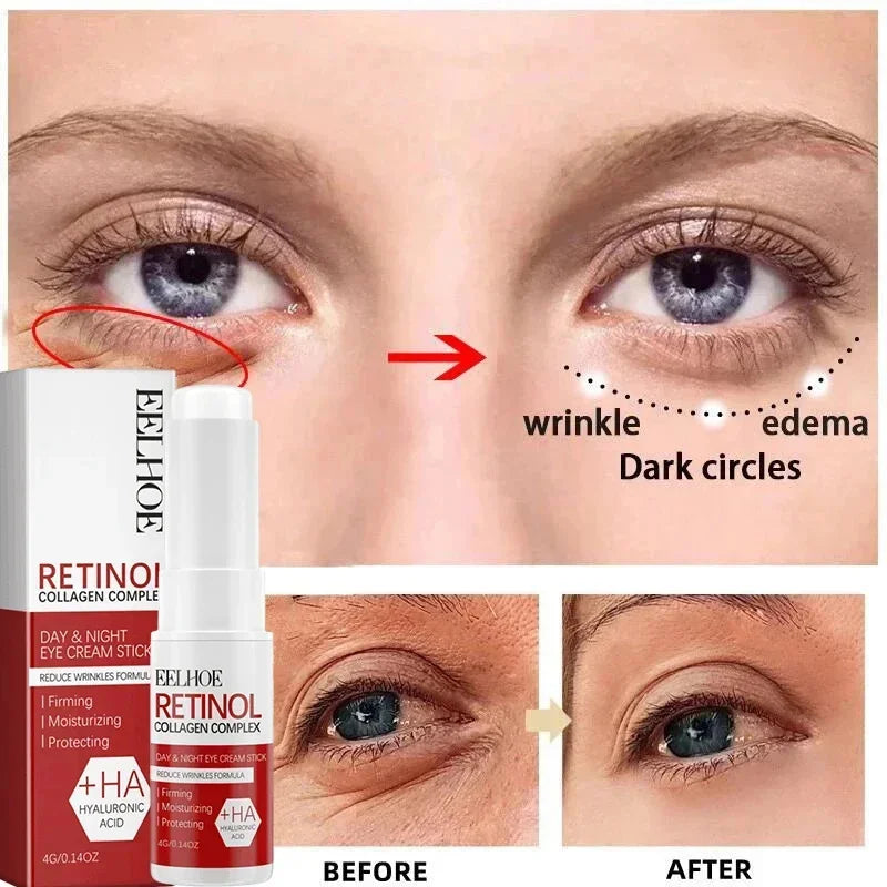 CONTORNO DE OJOS RETINOL