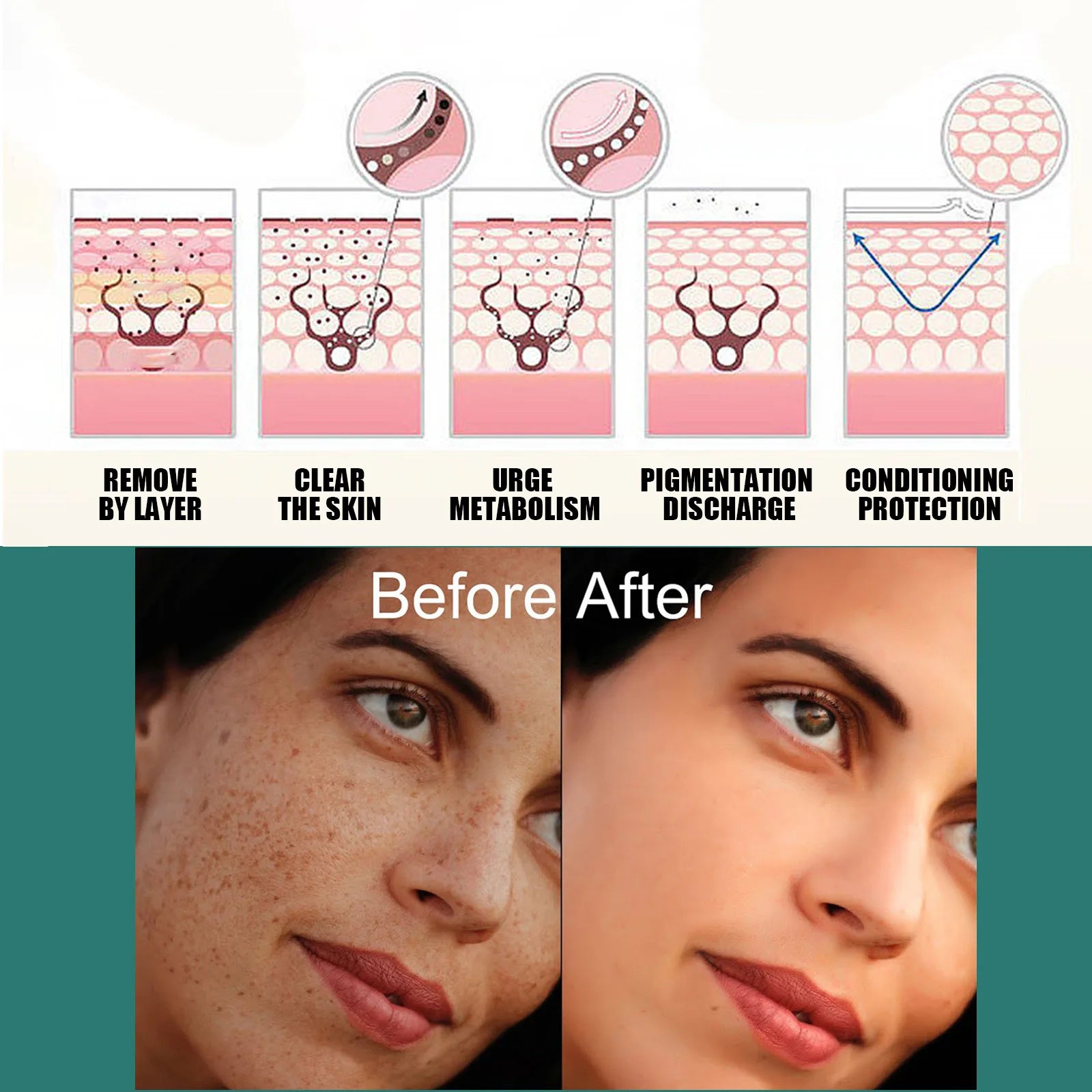 Vitamin C Whitening Freckles Face Cream Remove Melasma Dark Spots Lighten Melanin Acne Scar Anti-aging Brighten Face Skin Care