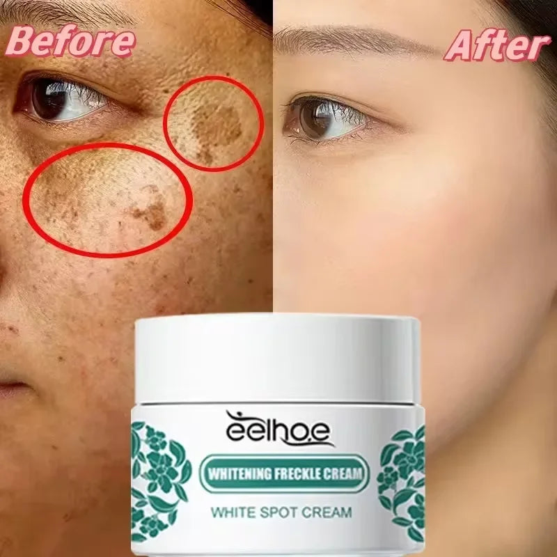 Vitamin C Whitening Freckles Face Cream Remove Melasma Dark Spots Lighten Melanin Acne Scar Anti-aging Brighten Face Skin Care