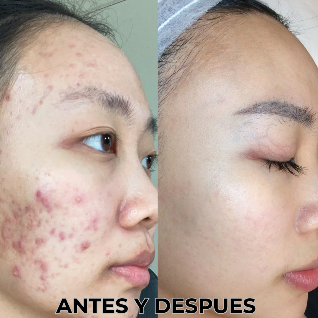 SERUM COREANO Anua® Niacinamide 10% + TXA 4%